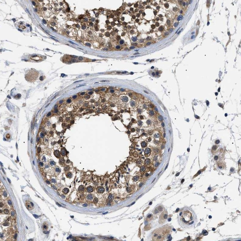 Immunohistochemical staining of human testis shows cytoplasmic and nuclear positivity of cells in seminiferus ducts.