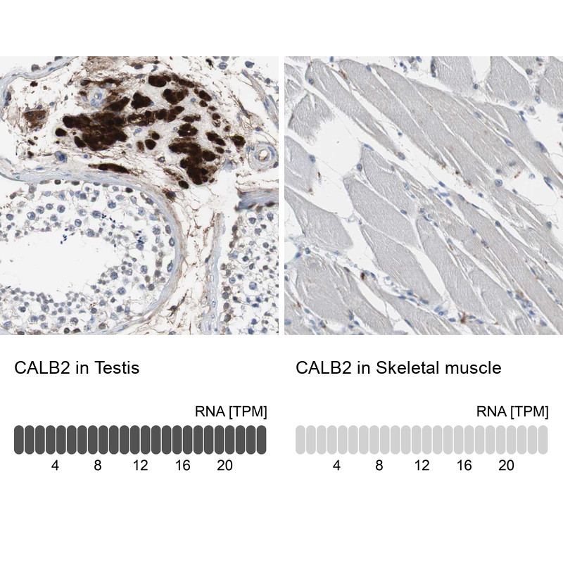 Immunohistochemistry analysis in human testis and skeletal muscle tissues using HPA007306 antibody. Corresponding CALB2 RNA-seq data are presented for the same tissues.