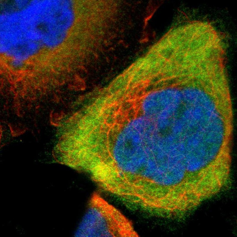 Immunofluorescent staining of human cell line A-431 shows localization to cytosol.