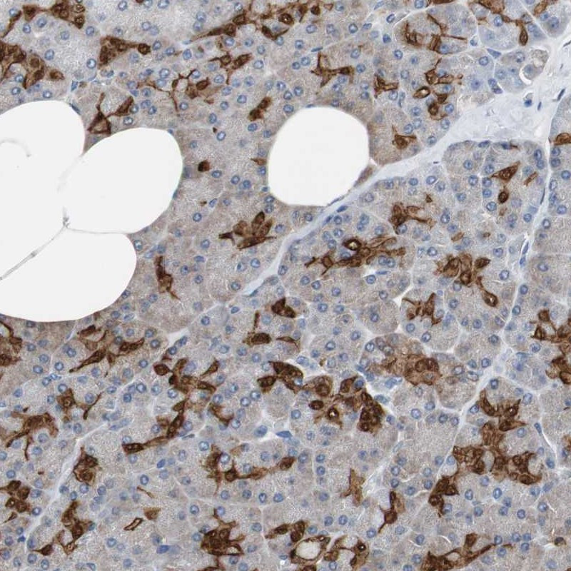 Immunohistochemical staining of human pancreas shows distinct positivity in ductal cells.