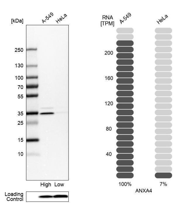 Western blot analysis in human cell lines A-549 and HeLa using Anti-ANXA4 antibody. Corresponding ANXA4 RNA-seq data are presented for the same cell lines. Loading control: Anti-COX4I1.