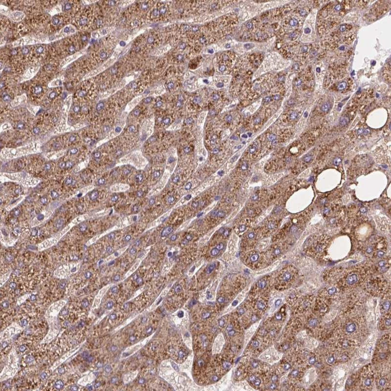 Immunohistochemical staining of human liver shows strong positivity with a granular pattern in hepatocytes.