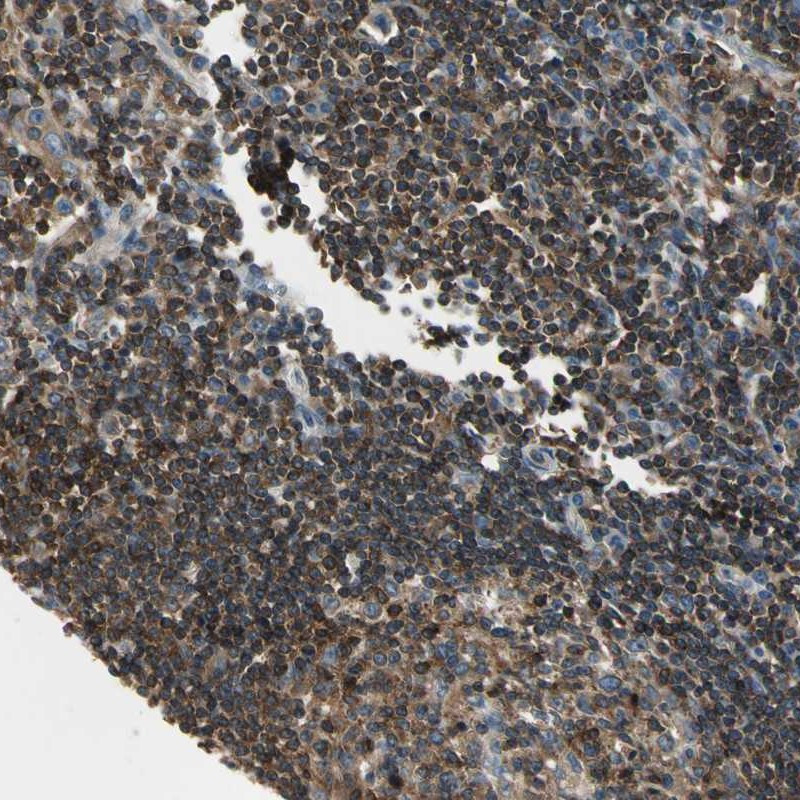Immunohistochemical staining of human lymph node shows cytoplasmic positivity in lymphoid cells outside reaction centra and reaction centre cells.