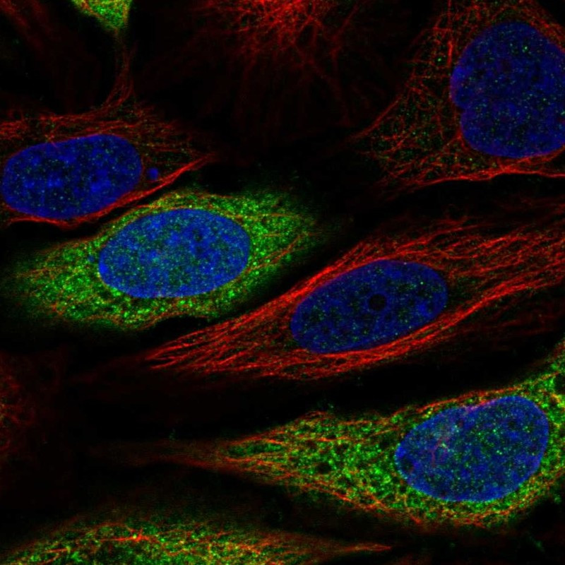 Immunofluorescent staining of human cell line SiHa shows localization to endoplasmic reticulum.