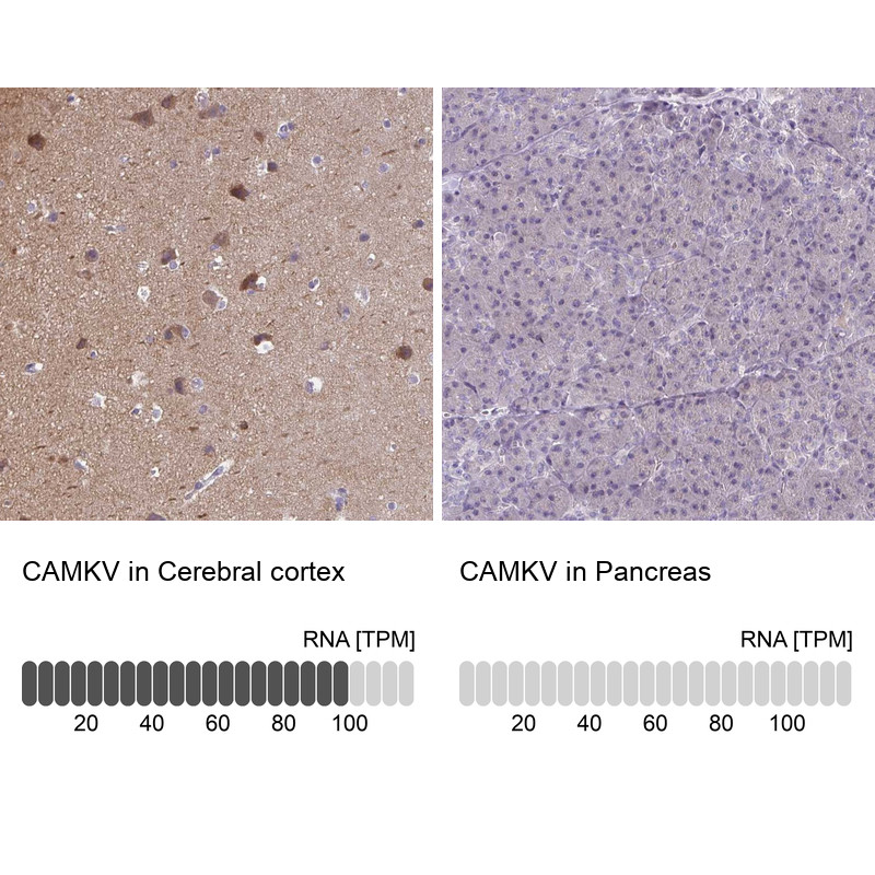 Immunohistochemistry analysis in human cerebral cortex and pancreas tissues using Anti-CAMKV antibody. Corresponding CAMKV RNA-seq data are presented for the same tissues.