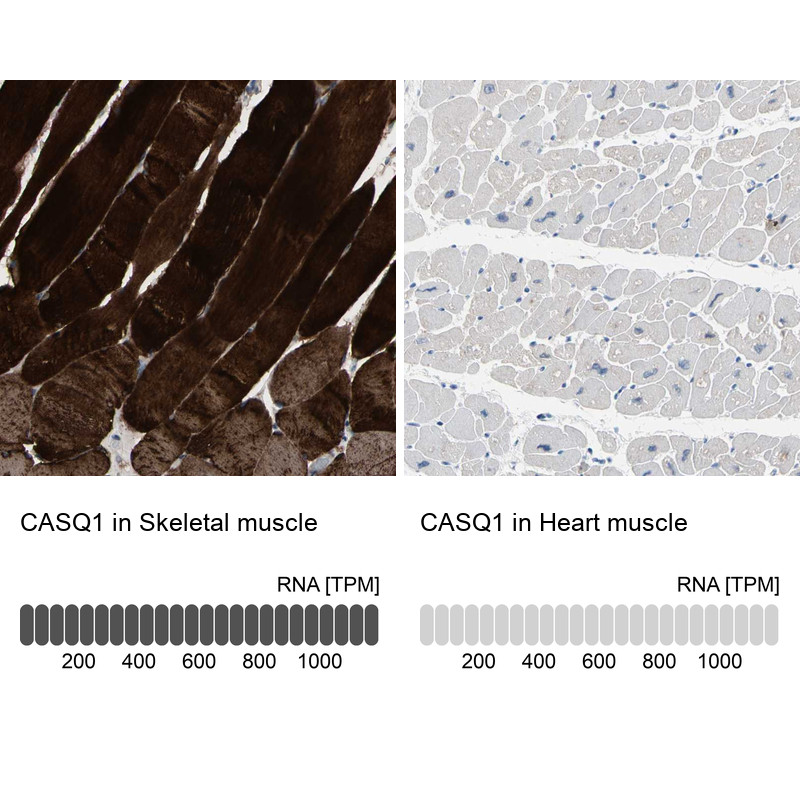 Immunohistochemistry analysis in human skeletal muscle and heart muscle tissues using Anti-CASQ1 antibody. Corresponding CASQ1 RNA-seq data are presented for the same tissues.