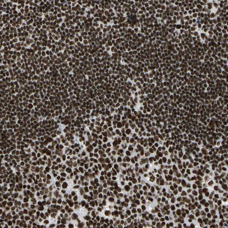 Immunohistochemical staining of human lymph node shows strong nuclear positivity in germinal center and non-germinal center cells.
