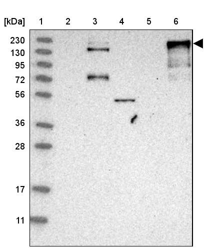 Lane 1: Marker [kDa] 230, 130, 95, 72, 56, 36, 28, 17, 11<br/>Lane 2: Human cell line RT-4<br/>Lane 3: Human cell line U-251MG sp<br/>Lane 4: Human plasma (IgG/HSA depleted)<br/>Lane 5: Human liver tissue<br/>Lane 6: Human tonsil tissue