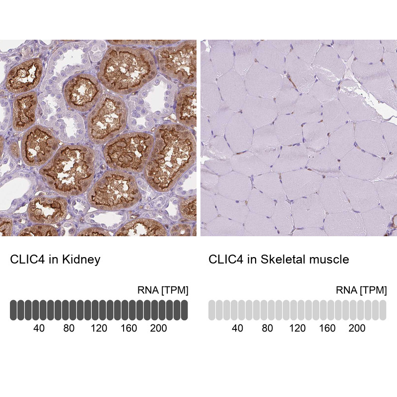 Immunohistochemistry analysis in human kidney and skeletal muscle tissues using HPA008019 antibody. Corresponding CLIC4 RNA-seq data are presented for the same tissues.