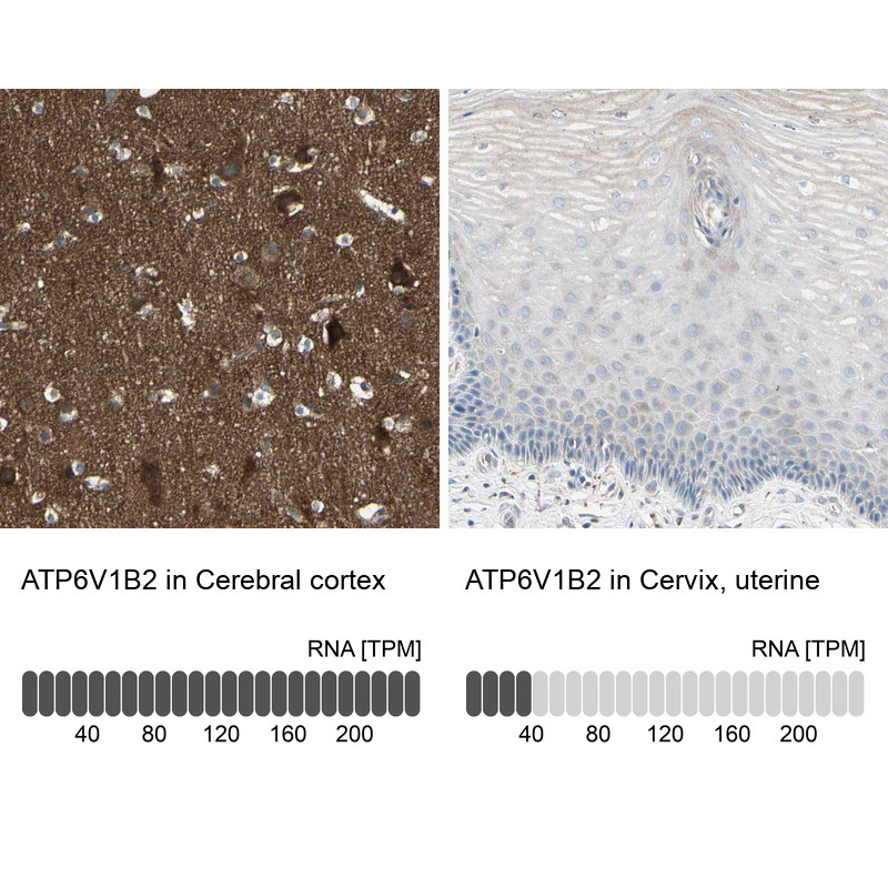 Immunohistochemistry analysis in human cerebral cortex and cervix, uterine tissues using HPA008147 antibody. Corresponding ATP6V1B2 RNA-seq data are presented for the same tissues.
