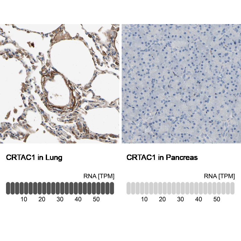 Immunohistochemistry analysis in human lung and pancreas tissues using Anti-CRTAC1 antibody. Corresponding CRTAC1 RNA-seq data are presented for the same tissues.