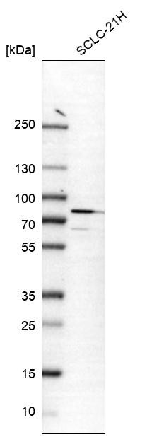 Lane 1: Marker [kDa] 250, 130, 100, 70, 55, 35, 25, 15, 10<br/>Lane 2: Human Lung tissue