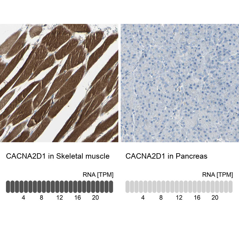Immunohistochemistry analysis in human skeletal muscle and pancreas tissues using HPA008213 antibody. Corresponding CACNA2D1 RNA-seq data are presented for the same tissues.