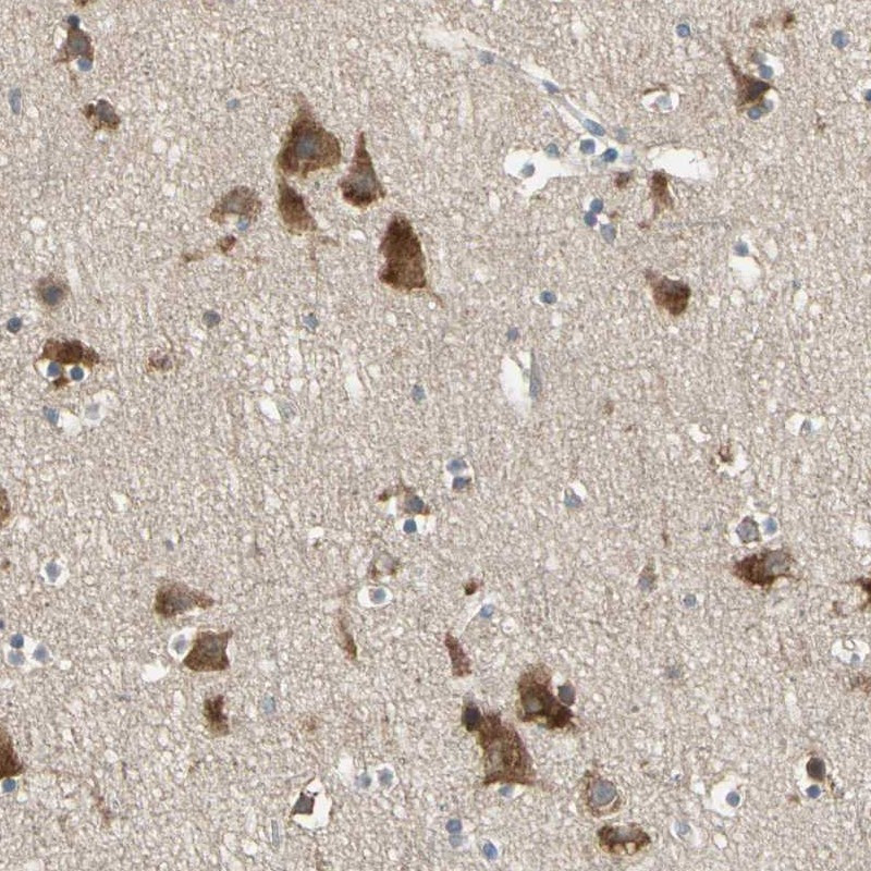 Immunohistochemical staining of human cerebral cortex shows strong cytoplasmic positivity in neuronal cells.