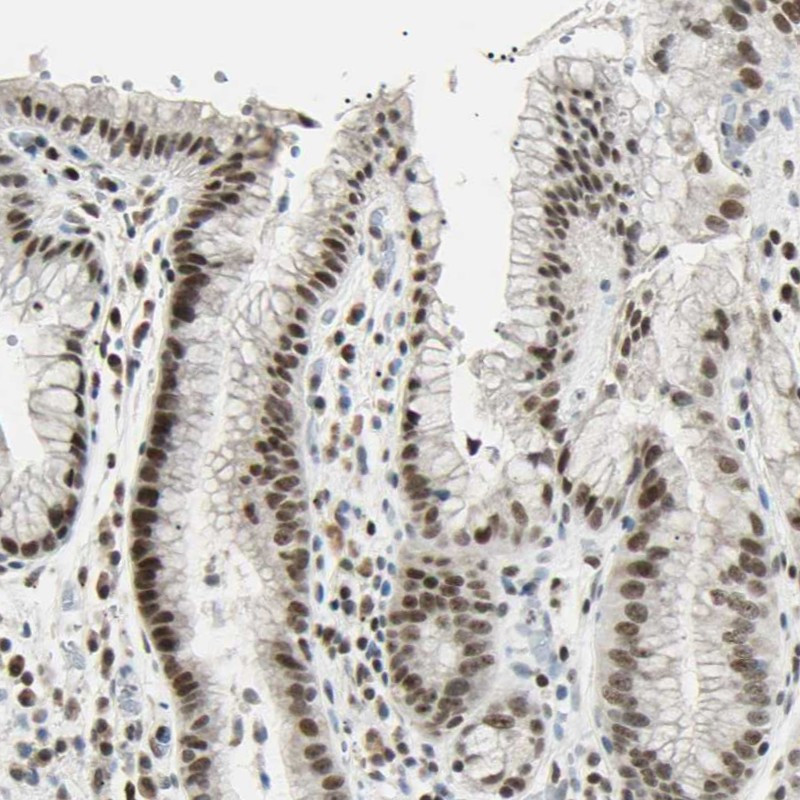 Immunohistochemical staining of human stomach shows moderate nuclear positivity in glandular cells.