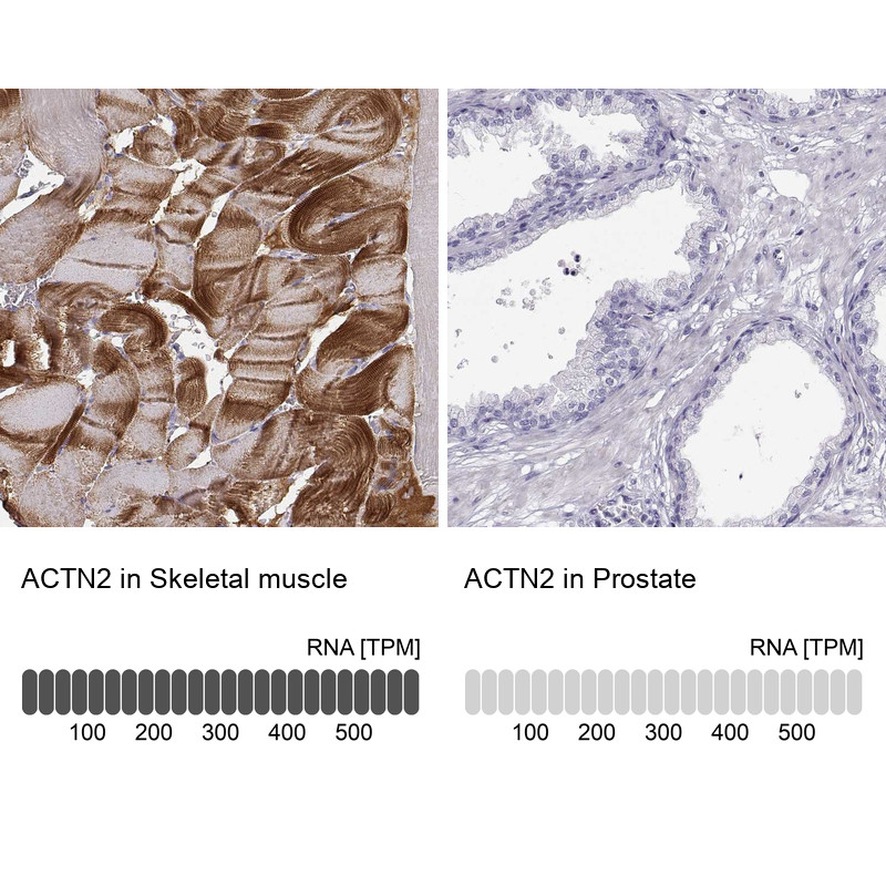 Immunohistochemistry analysis in human skeletal muscle and prostate tissues using Anti-ACTN2 antibody. Corresponding ACTN2 RNA-seq data are presented for the same tissues.