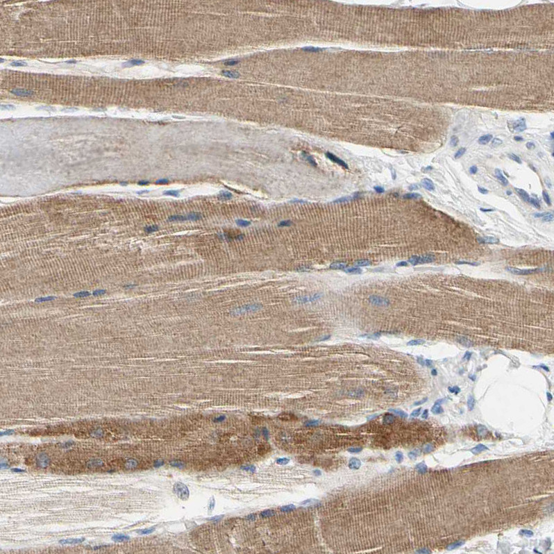 Immunohistochemical staining of human skeletal muscle shows moderate cytoplasmic positivity in myocytes.
