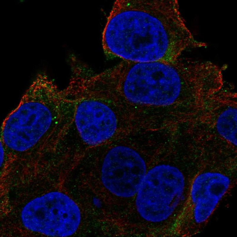 Immunofluorescent staining of human cell line SK-MEL-30 shows localization to plasma membrane.