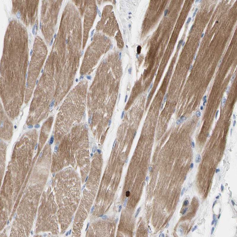 Immunohistochemical staining of human skeletal muscle shows moderate cytoplasmic positivity in myocytes.