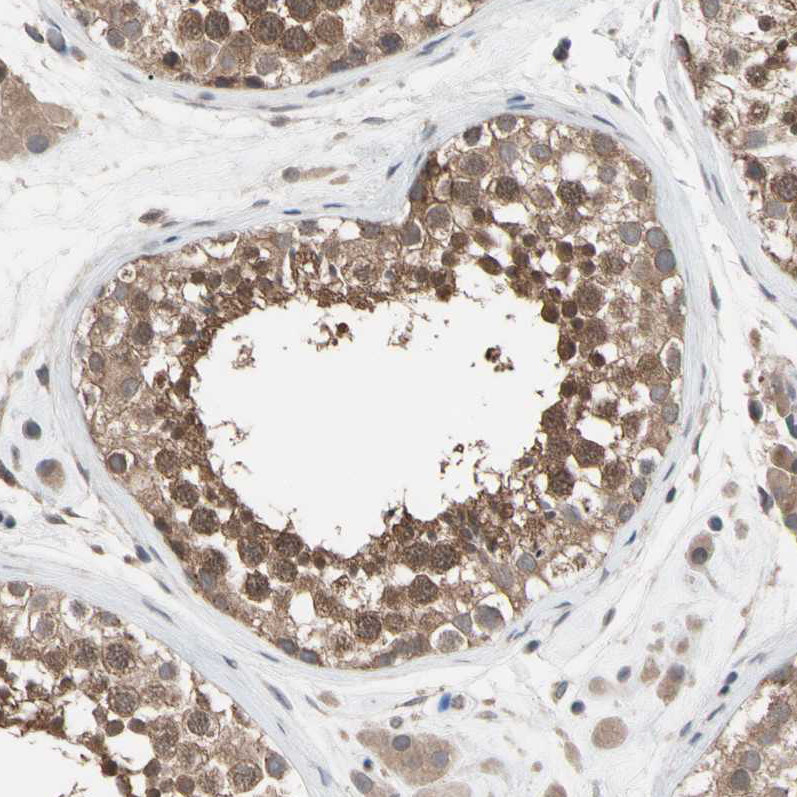Immunohistochemical staining of human testis shows moderate cytoplasmic positivity in cells in seminiferous ducts.