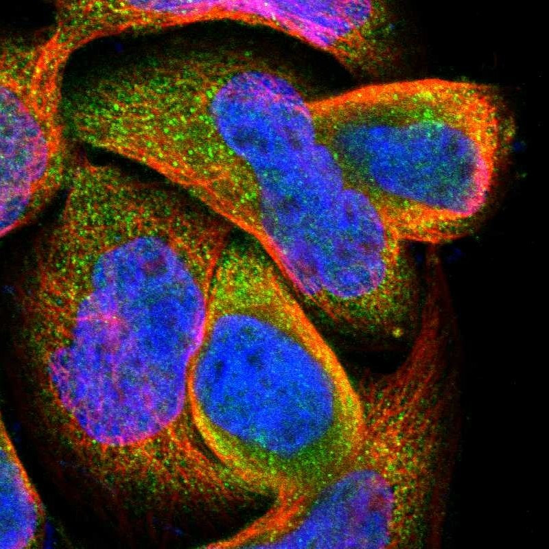 Immunofluorescent staining of human cell line A-431 shows positivity in cytoplasm.