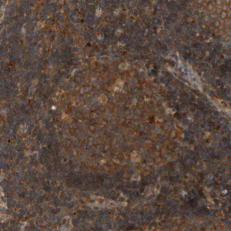 Immunohistochemical staining of human lymph node shows strong cytoplasmic positivity in germinal and non germinal center cells.