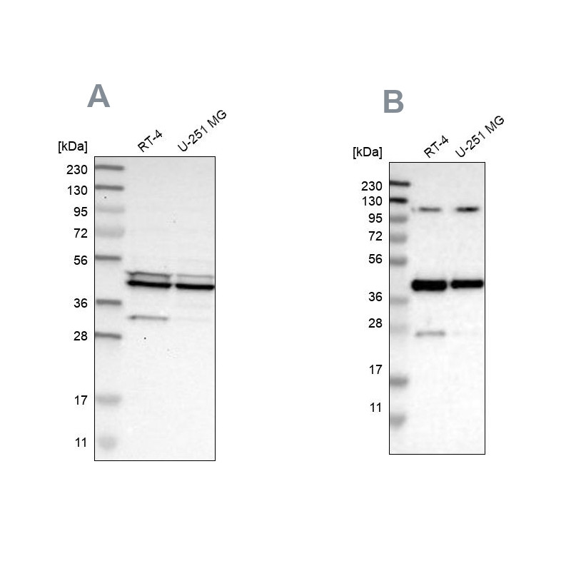 Western blot analysis using Anti-CFAP36 antibody HPA008994 (A) shows similar pattern to independent antibody HPA017061 (B).