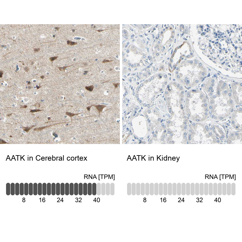 Immunohistochemistry analysis in human cerebral cortex and kidney tissues using Anti-AATK antibody. Corresponding AATK RNA-seq data are presented for the same tissues.