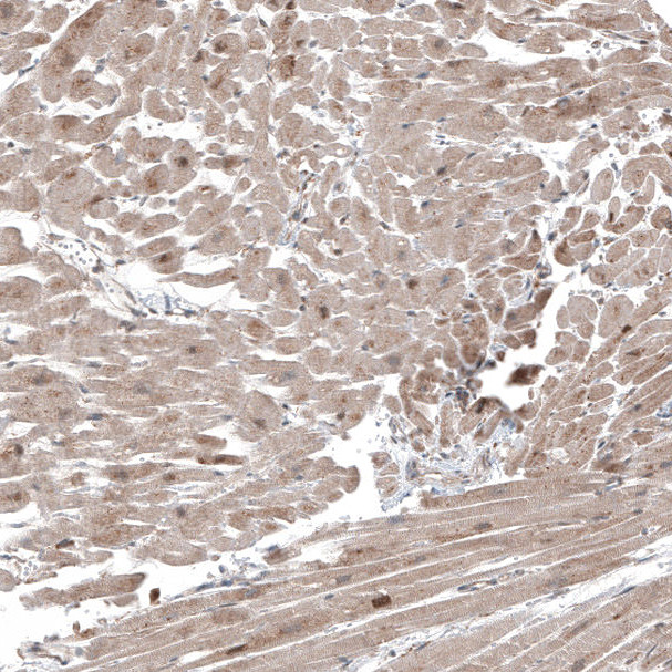 Immunohistochemical staining of human Heart muscle shows moderate cytoplasmic positivity in cardiomyocytes.