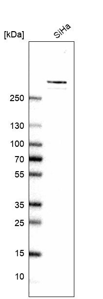 Western blot analysis in human cell line SiHa.