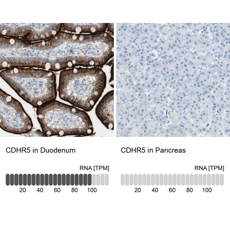 Immunohistochemistry analysis in human duodenum and pancreas tissues using HPA009173 antibody. Corresponding CDHR5 RNA-seq data are presented for the same tissues.