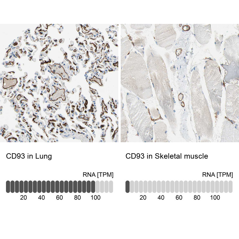 Immunohistochemistry analysis in human lung and skeletal muscle tissues using HPA009300 antibody. Corresponding CD93 RNA-seq data are presented for the same tissues.