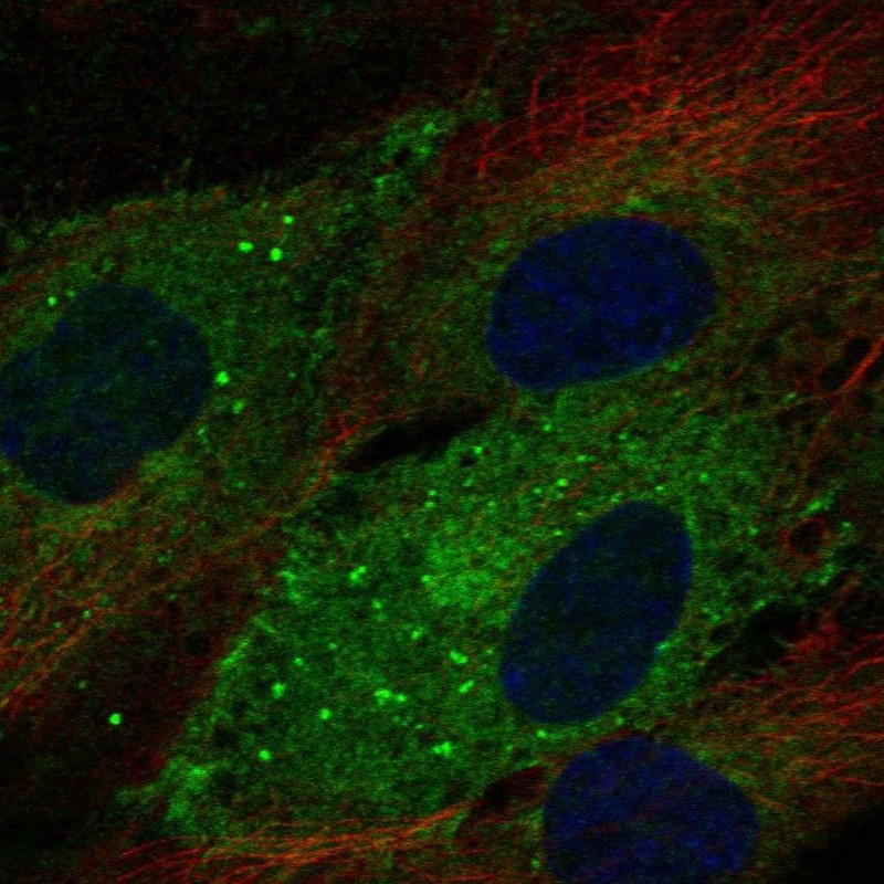 Immunofluorescent staining of human cell line HUVEC TERT2 shows localization to plasma membrane & vesicles.