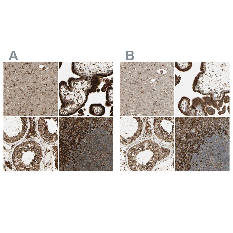 Immunohistochemical staining of human cerebral cortex, placenta, testis and tonsil using Anti-CANX antibody HPA009433 (A) shows similar protein distribution across tissues to independent antibody HPA009696 (B).