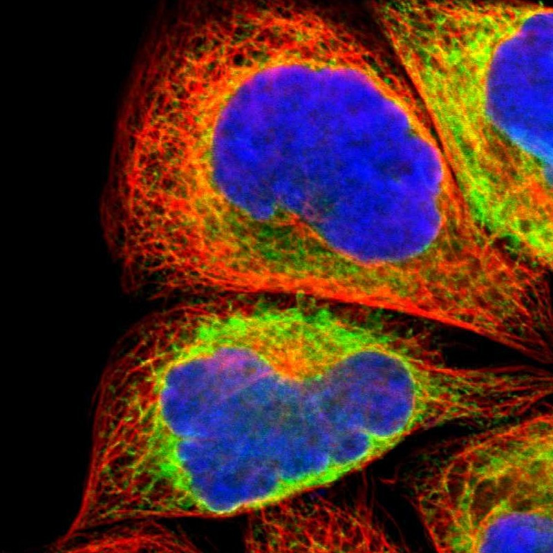 Immunofluorescent staining of human cell line A-431 shows localization to endoplasmic reticulum.