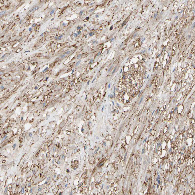 Immunohistochemical staining of human prostate shows strong cytoplasmic positivity in smooth muscle cells.