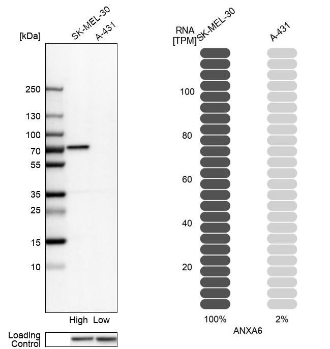 Western blot analysis in human cell lines SK-MEL-30 and A-431 using Anti-ANXA6 antibody. Corresponding ANXA6 RNA-seq data are presented for the same cell lines. Loading control: Anti-HSP90B1.