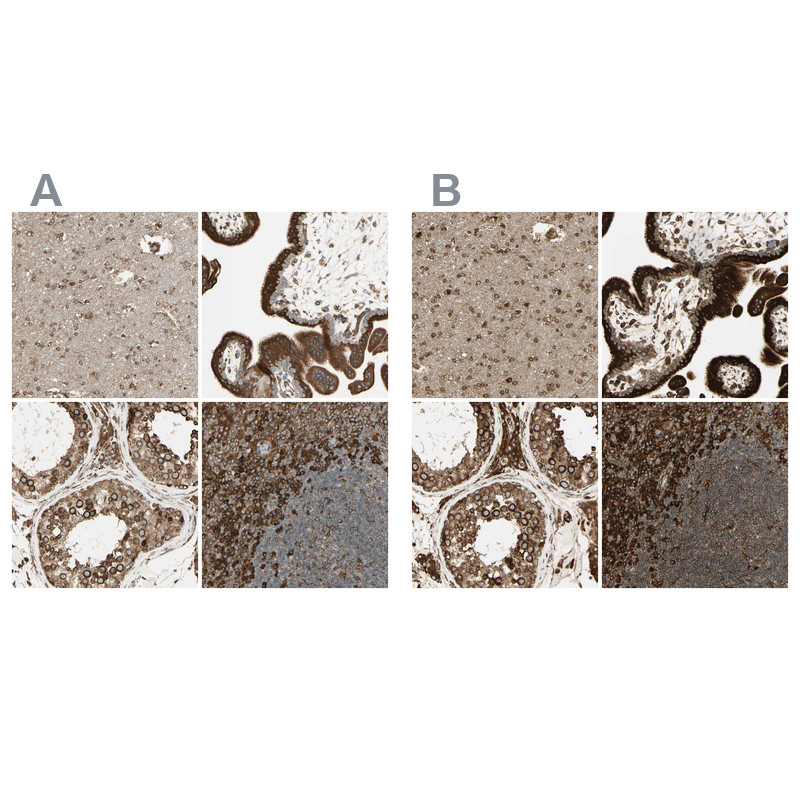 Immunohistochemical staining of human cerebral cortex, placenta, testis and tonsil using Anti-CANX antibody HPA009696 (A) shows similar protein distribution across tissues to independent antibody HPA009433 (B).