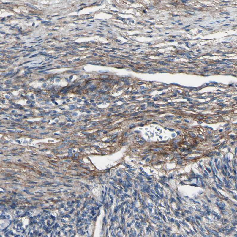 Immunohistochemical staining of human ovary shows moderate cytoplasmic positivity in connective tissues.