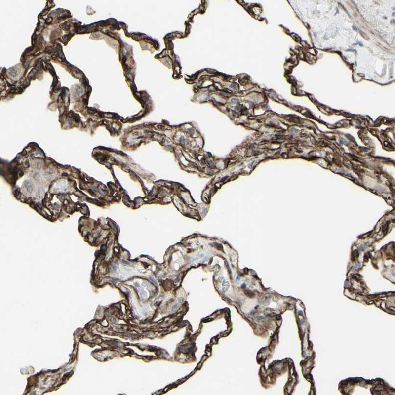Immunohistochemical staining of human lung shows strong cytoplasmic and membranous positivity in alveolar cells.