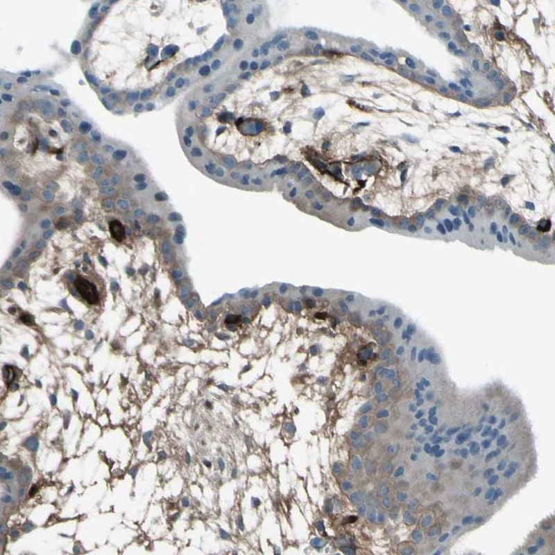 Immunohistochemical staining of human placenta shows extra cellular positivity.