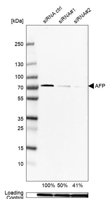 Western blot analysis in Hep-G2 cells transfected with control siRNA, target specific siRNA probe #1 and #2, using Anti-AFP antibody. Remaining relative intensity is presented. Loading control: Anti-GAPDH.