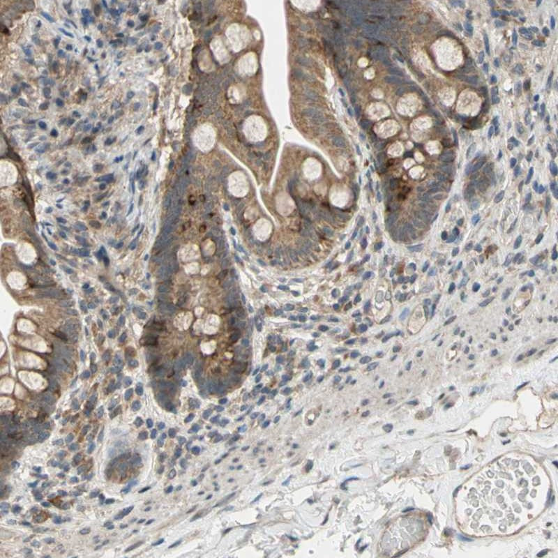 Immunohistochemical staining of human small intestine shows moderate cytoplasmic positivity in glandular cells.