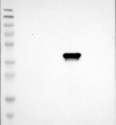 Lane 1: Marker [kDa] 230, 130, 95, 72, 56, 36, 28, 17, 11 | Lane 2: RT4 | Lane 3: U-251 MG | Lane 4: Human Plasma | Lane 5: Liver | Lane 6: Tonsil