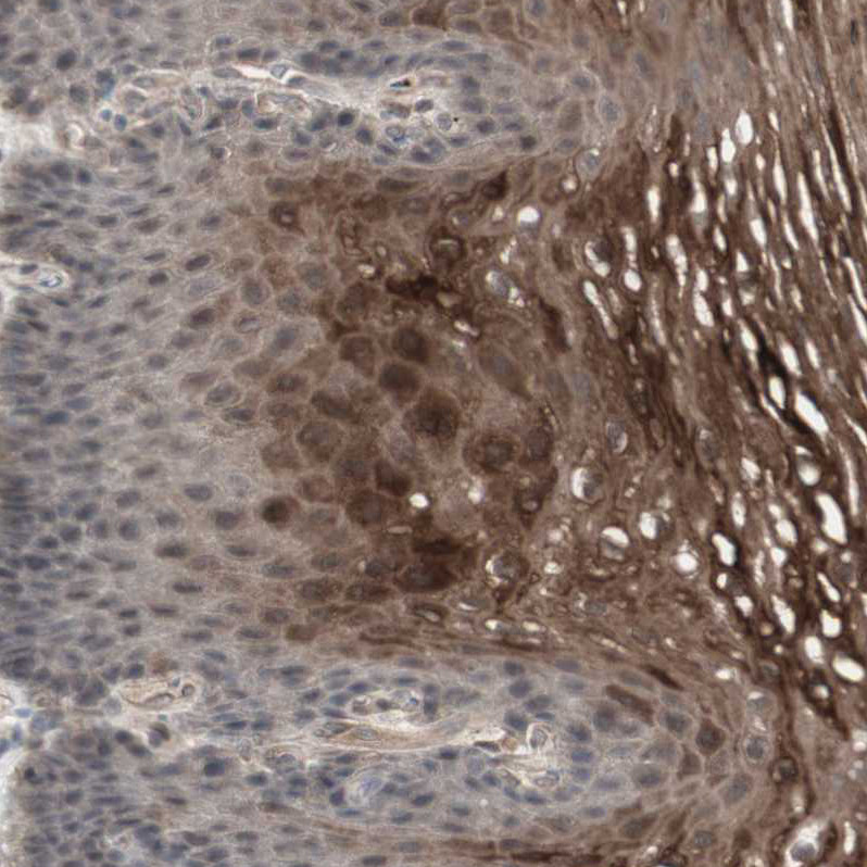 Immunohistochemical staining of human esophagus shows strong cytoplasmic positivity in squamous epithelial cells.