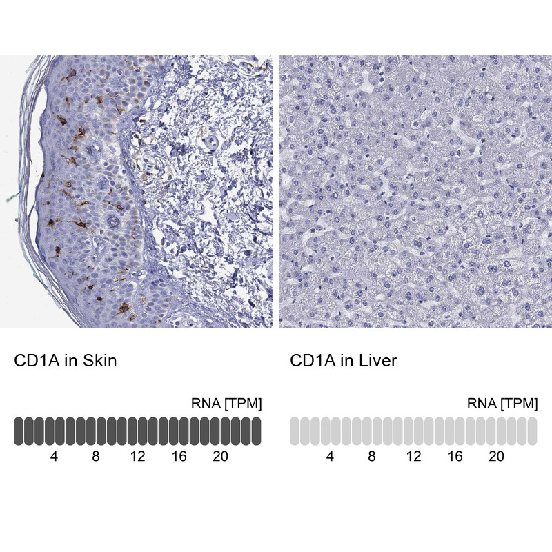 Immunohistochemistry analysis in human skin and liver tissues using HPA010734 antibody. Corresponding CD1A RNA-seq data are presented for the same tissues.