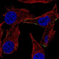 Immunofluorescent staining of human cell line SK-MEL-30 shows localization to plasma membrane & vesicles.