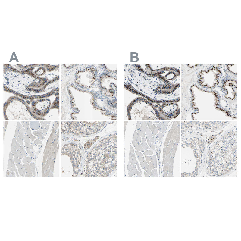 Immunohistochemical staining of human placenta, prostate, skeletal muscle and testis using Anti-B4GALT1 antibody HPA010806 (A) shows similar protein distribution across tissues to independent antibody HPA010807 (B).