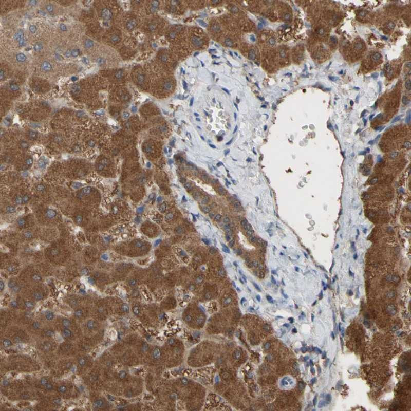 Immunohistochemical staining of human liver shows strong cytoplasmic positivity in hepatocytes.