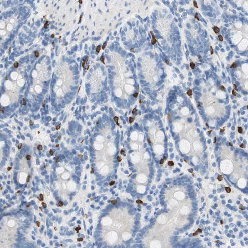 Immunohistochemical staining of human duodenum shows strong cytoplasmic positivity in a subset of leukocytes.